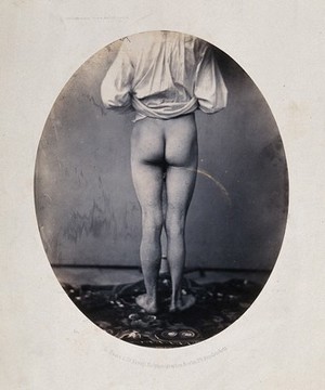 view A man, viewed from behind, with naked legs and buttocks. Photograph by L. Haase after H.W. Berend, 1860.