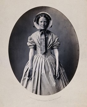 A woman standing, viewed from the front, wearing striped dress and bonnet, hands and forearms revealed. Photograph by L. Haase after H.W. Berend, 1860.