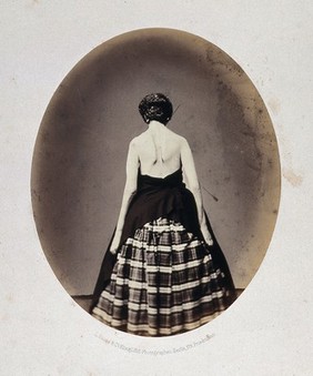 A standing woman, viewed from behind whose striped skirt has been covered with black cloth, revealing her arms and shoulders. Photograph by L. Haase after H.W. Berend, 1862.