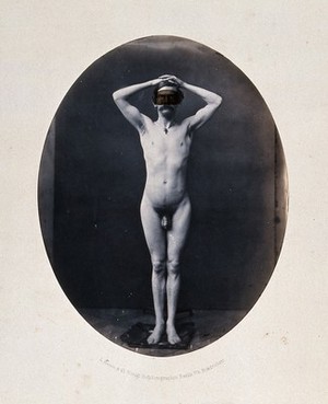 view A man standing, naked, full-length, with hands on head. Photograph by L. Haase after H.W. Berend, 1861.