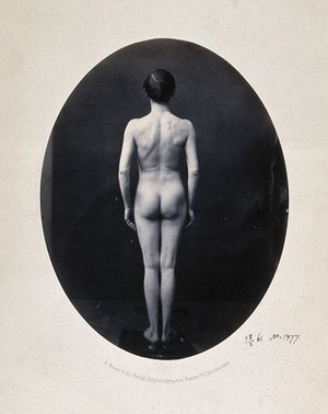 view A man standing, naked, full-length, viewed from behind. Photograph by L. Haase after H.W. Berend, 1861.