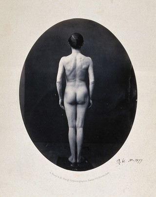 A man standing, naked, full-length, viewed from behind. Photograph by L. Haase after H.W. Berend, 1861.