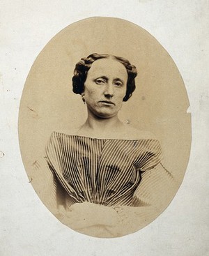 view Female, head and shoulders, face tilted toward left shoulder. Photograph by L. Haase, after H.W. Berend, 1863.