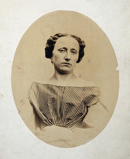Female, head and shoulders, face tilted toward left shoulder. Photograph by L. Haase, after H.W. Berend, 1863.