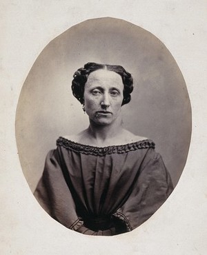 view A woman, head and shoulders, viewed from the front. Photograph by L. Haase after H.W. Berend, 1863.