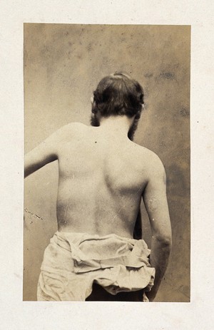 view A bearded man, unclothed to his waist and viewed from behind; his left arm slightly raised. Photograph by L. Haase after H.W. Berend, 1863.