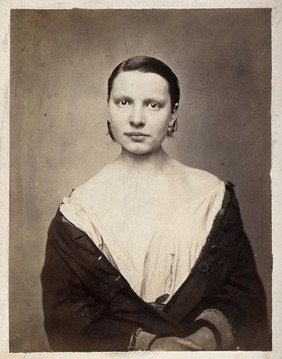 A woman, head and shoulders; she has a bump on her right shoulder. Photograph by L. Haase after H.W. Berend, 1864.