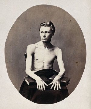 view A young man, seated and unclothed to waist, with his wrists resting on books upon his lap. Photograph by L. Haase after H.W. Berend, 1864.
