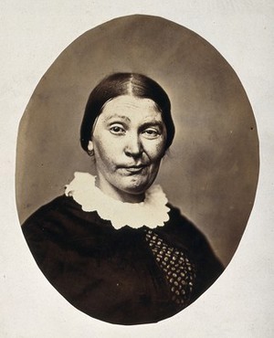 view A woman's head and shoulders; her mouth is twisted into a grimace. Photograph by L. Haase after H.W. Berend, 1864.