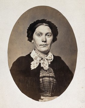 A woman's head and shoulders; her mouth shows a slight grimace. Photograph by L. Haase after H.W. Berend, 1864.