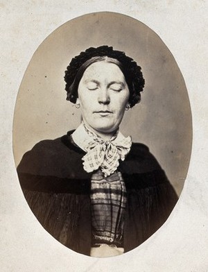 view A woman's head and shoulders; her eyes are closed and her mouth shows a slight grimace. Photograph by L. Haase after H.W. Berend, 1864.