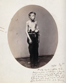 A boy, standing, viewed in full length, naked to the waist. Photograph by L. Haase after H.W. Berend, 1864.