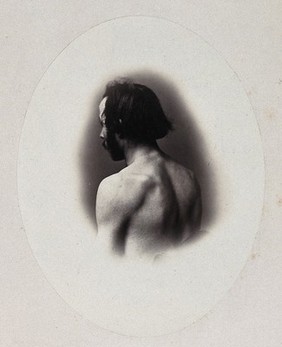 A man's head and left shoulder, unclothed and viewed from behind. Photograph by L. Haase after H.W. Berend, 1865.