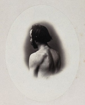 view A man's head and left shoulder, unclothed and viewed from behind. Photograph by L. Haase after H.W. Berend, 1865.