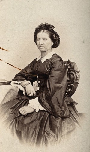 view A woman sitting down, her right eyelid is heavier than her left. Photograph by L. Haase after H.W. Berend, 1865.