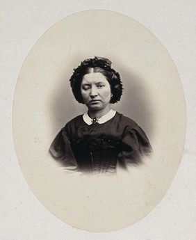 A woman's head and shoulders, her right eyelid is heavier than her left. Photograph by L. Haase after H.W. Berend, 1865.