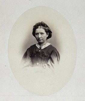 A woman's head and shoulders, her right eye is facing in a different direction to her left. Photograph by L. Haase after H.W. Berend, 1865.