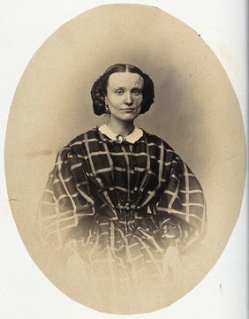 A woman seated; the left side of her face appears slightly deformed. Photograph by L. Haase for H.W. Berend, c. 1865.