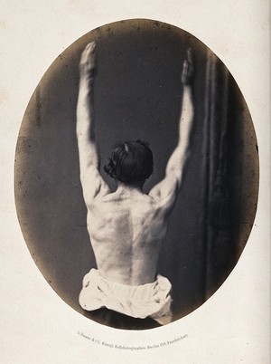 view A partially clothed man, viewed from behind; his arms are raised in the air, showing the muscles on his back. Photograph by L. Haase after H.W. Berend, c. 1865.