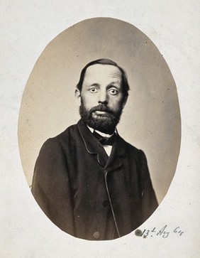 A seated man, head and shoulders; the right side of his face is different from the left. Photograph by L. Haase after H.W. Berend, 1864.