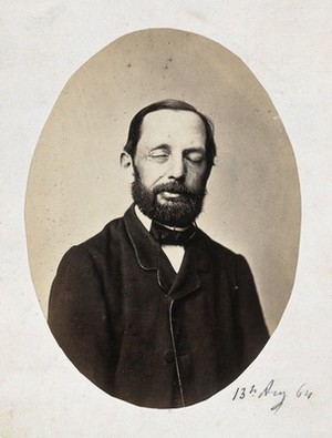 view A seated man, head and shoulders; the right side of his face is different from the left. Photograph by L. Haase after H.W. Berend, 1864.