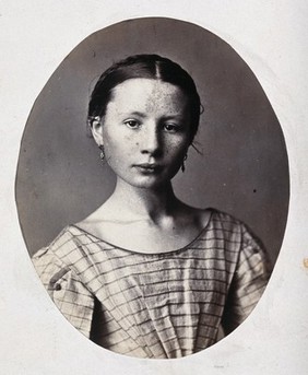 A young woman, head and shoulders. Photograph by L. Haase after H.W. Berend, c. 1865.
