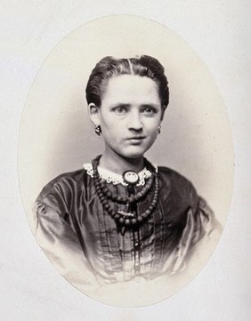 A young woman, head and shoulders; her face is slightly contorted. Photograph by L. Haase after H.W. Berend, c. 1865.