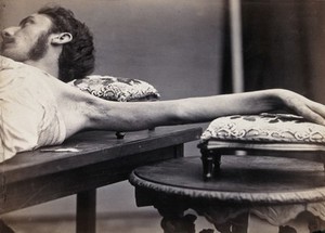 view A man, lying down, his left arm outstretched. Photograph by L. Haase after H.W. Berend, c. 1865.