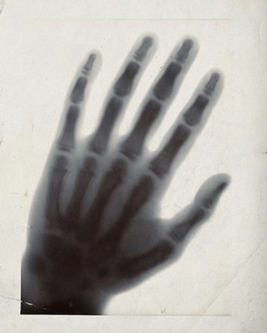 view The bones of a hand, viewed through x-ray. Photoprint from radiograph after Sir Arthur Schuster, 1896.