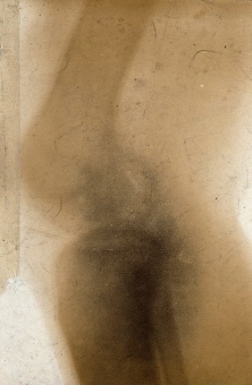 A knee joint, viewed through x-ray. Photoprint from radiograph after Sir Arthur Schuster, 1896.