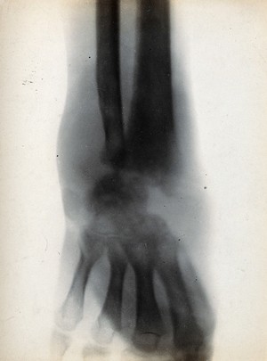 view The bones of the wrist, viewed through x-ray. Photoprint from radiograph after Sir Arthur Schuster, 1896.