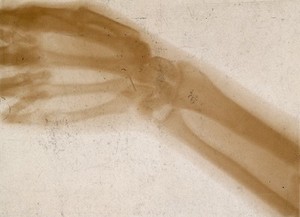 view The bones of a hand and wrist, viewed through x-ray. Photoprint from radiograph after Sir Arthur Schuster, 1896.