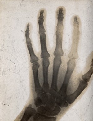 view The bones of a hand, viewed through x-ray. Photoprint from radiograph after Sir Arthur Schuster, 1896.