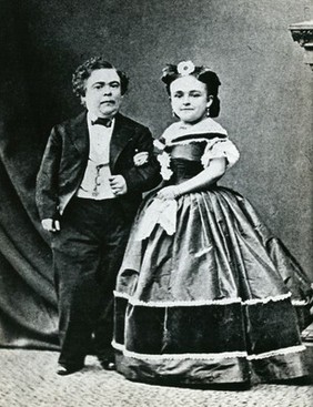 Two dwarfs: "Tom Thumb" (Charles Sherwood Stratton) (1838-1883) and his wife Lavinia Warren Stratton (1841-1919). Photograph, c. 1865.