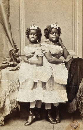 The Millie-Christine sisters, conjoined twins: aged 19, standing. Photograph, 1871.