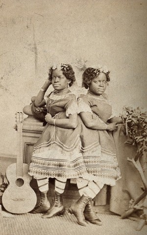 view The Millie-Christine sisters, conjoined twins, standing. Photograph, c. 1871.