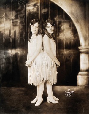 view Daisy and Violet Hilton, conjoined twins, dressed up for performance. Photograph, c. 1927.