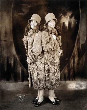 Daisy and Violet Hilton, conjoined twins, wearing fur coats. Photograph, c. 1927.