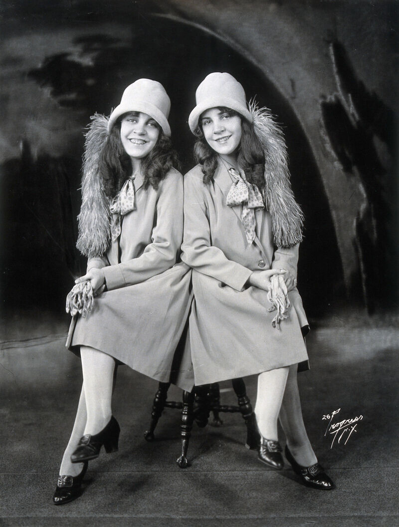 Daisy And Violet Hilton Conjoined Twins Dressed To Go Out Photograph