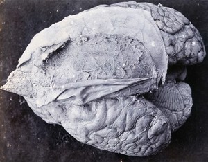 view Friern Hospital, London: a brain. Photograph, 1890/1910.