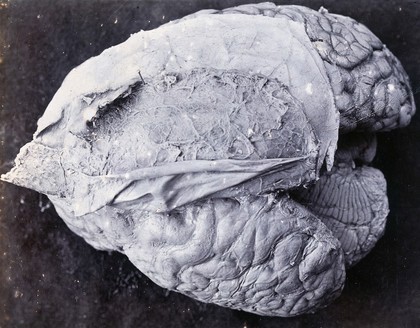 Friern Hospital, London: a brain. Photograph, 1890/1910.