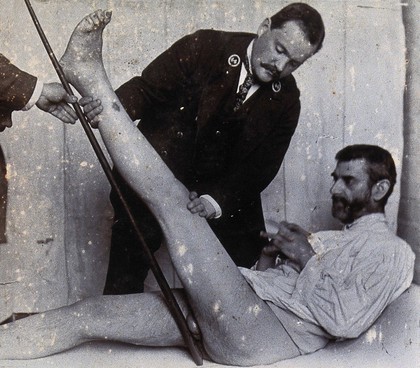 Friern Hospital, London: a patient being tested for his ability to raise his leg straight. Photograph, 1890/1910.