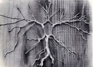 view Friern Hospital, London: dissected arteries stretched out and pinned onto a wooden board. Photograph, 1890/1910.