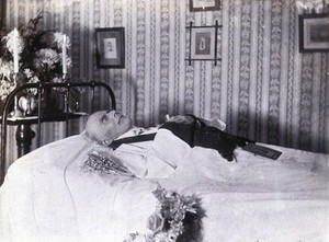 view Friern Hospital, London: a dead man, probably a clergyman. Photograph, 1890/1910.