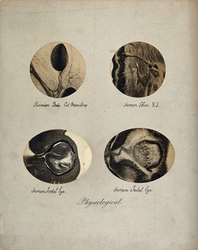 Cat mesentery, human skin and two human foetal eyes, seen through a microscope. Four photographs by A. Pringle.