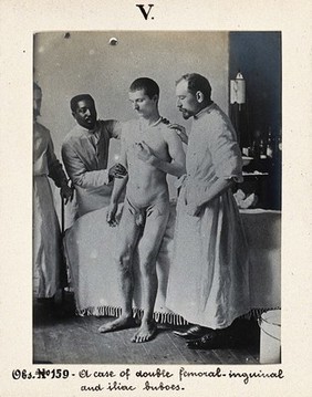 Seamen's Hospital for infectious diseases in Jurujuba, Rio de Janeiro; naked male plague patient being helped to his feet by medical staff. Photograph, 1904/1911.