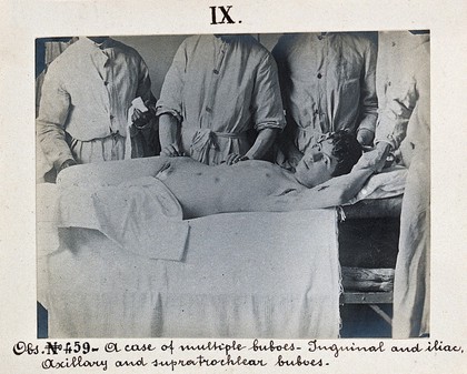 Seamen's Hospital for infectious diseases in Jurujuba, Rio de Janeiro; a young male plague patient lying on a bed, being treated by members of the medical team. Photograph, 1904/1911.