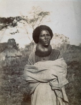 Woman, front view, probably with elephantiasis of the neck, Abyssinia. Photograph, 1904.