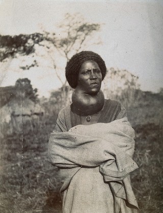 Woman, front view, probably with elephantiasis of the neck (or goitre?), Abyssinia. Photograph, 1904.