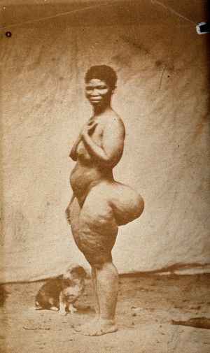 view A standing woman, full-length side view, with enlargement of the buttocks (steatopygia). Photograph.